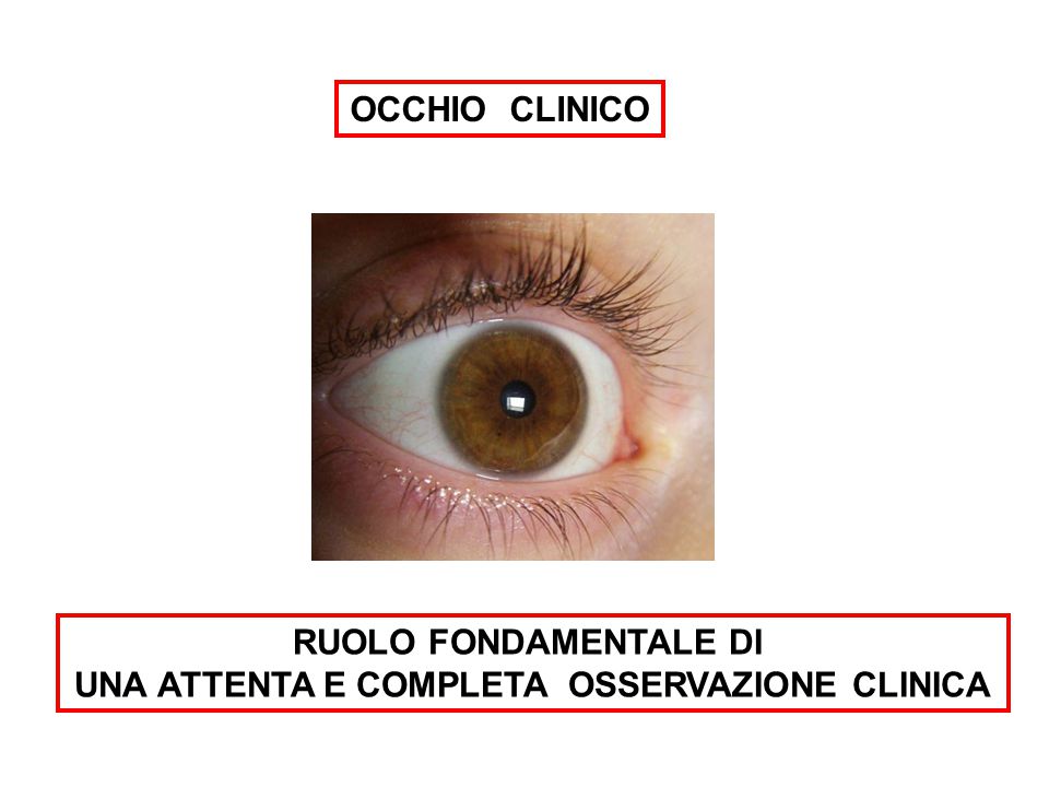 Occhio clinico